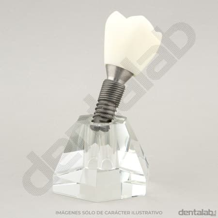 MacroModelo 1 Pieza (Implante con Corona)