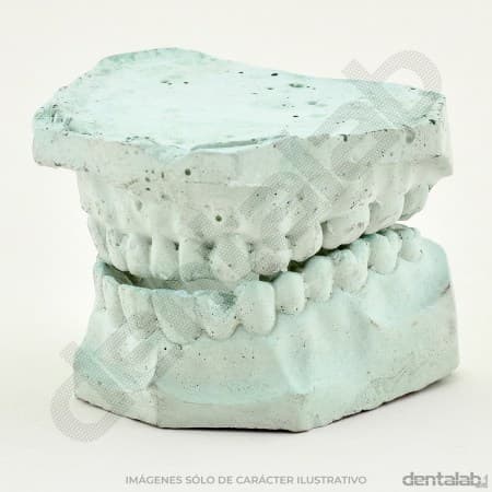 Modelo de Yeso Dentado x Par