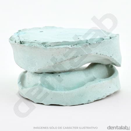 Modelo de Yeso Desdentado x Par