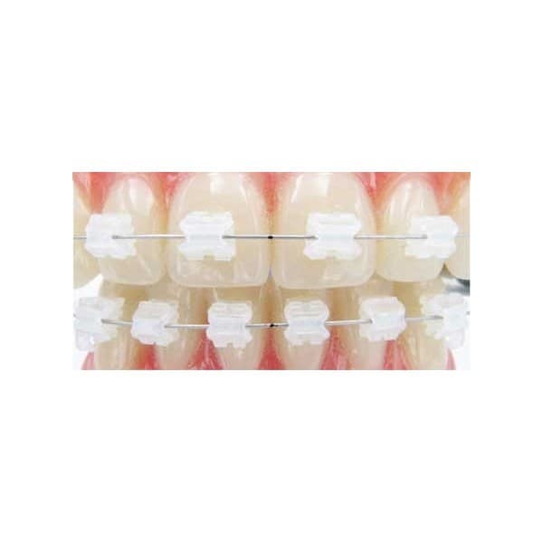 BRACKETS C.D. ESTÉTICOS AQUA DE CERÁMICA SISTEMA RICKETTS (.018″x.030″) – 1/6/12/20 BRACKETS