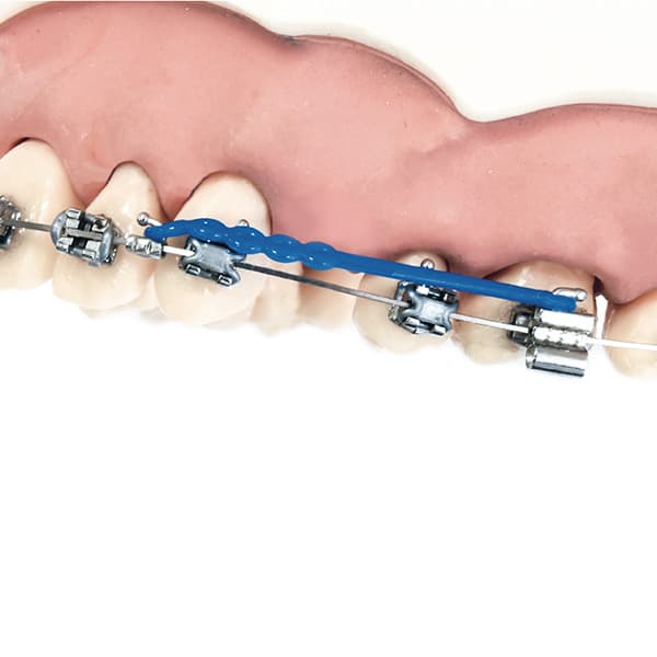 ARCOS ESPECIALES BIDIMENSIONALES BETA MEMORIA®/ACERO CON GANCHO – SUPERIORES E INFERIORES