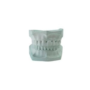 Modelo de yeso x par